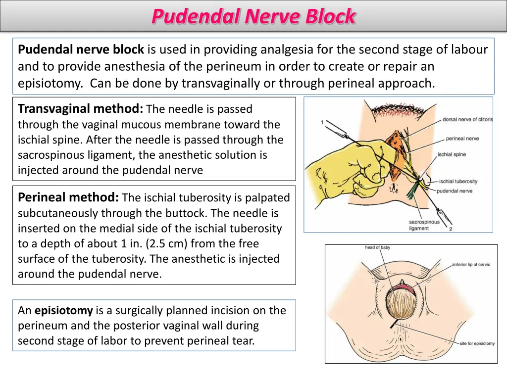 pudendal nerve block