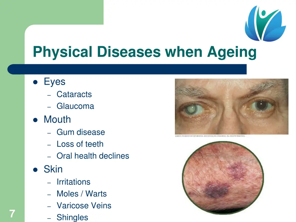 physical diseases when ageing