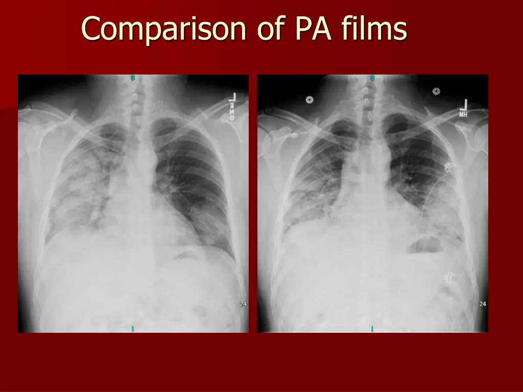 comparison of pa films