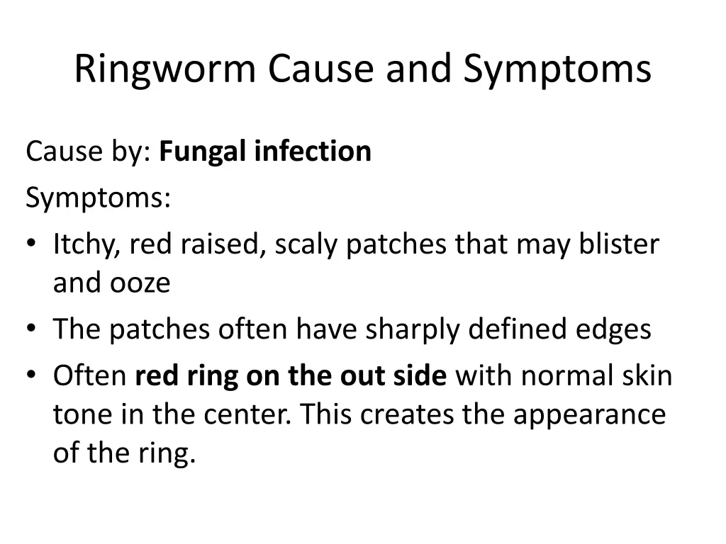 ringworm cause and symptoms