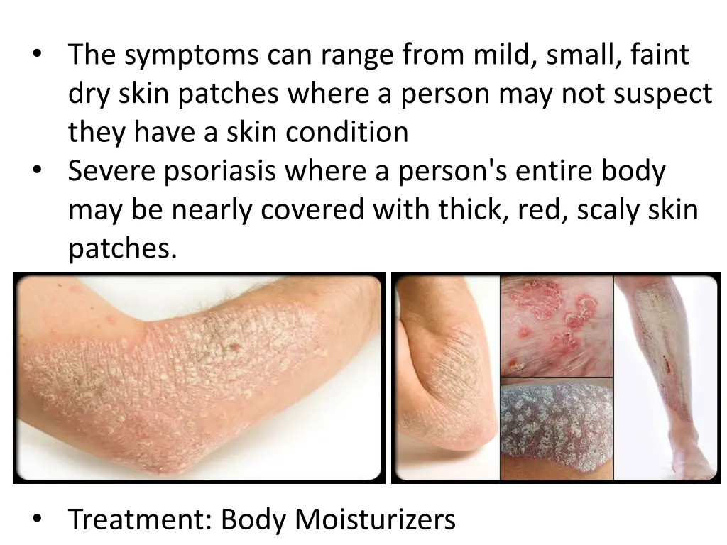 the symptoms can range from mild small faint