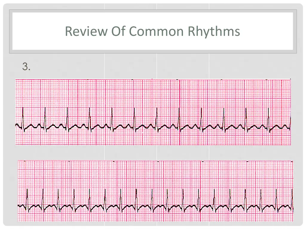 review of common rhythms 1