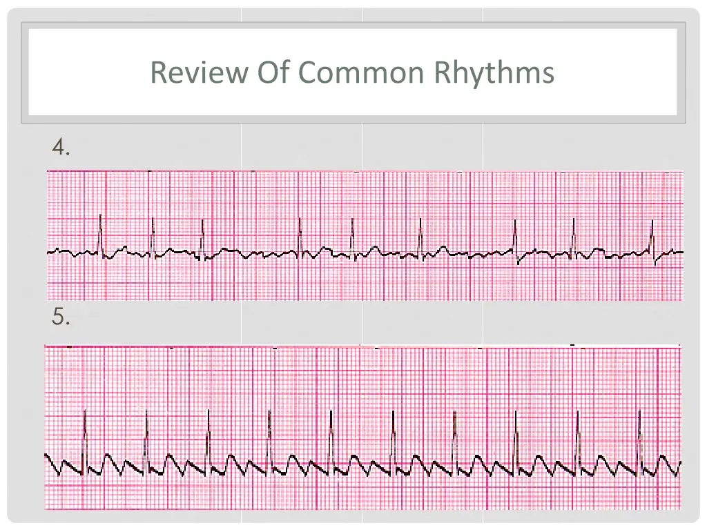 review of common rhythms 2