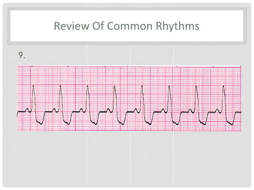 review of common rhythms 5