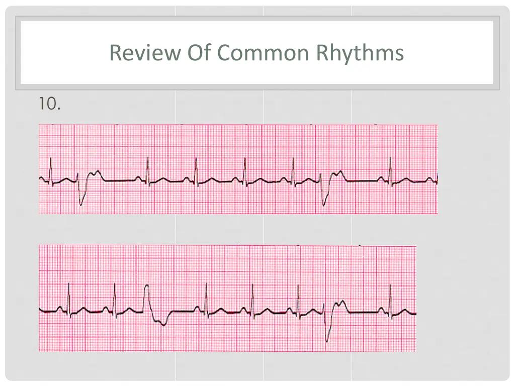 review of common rhythms 6