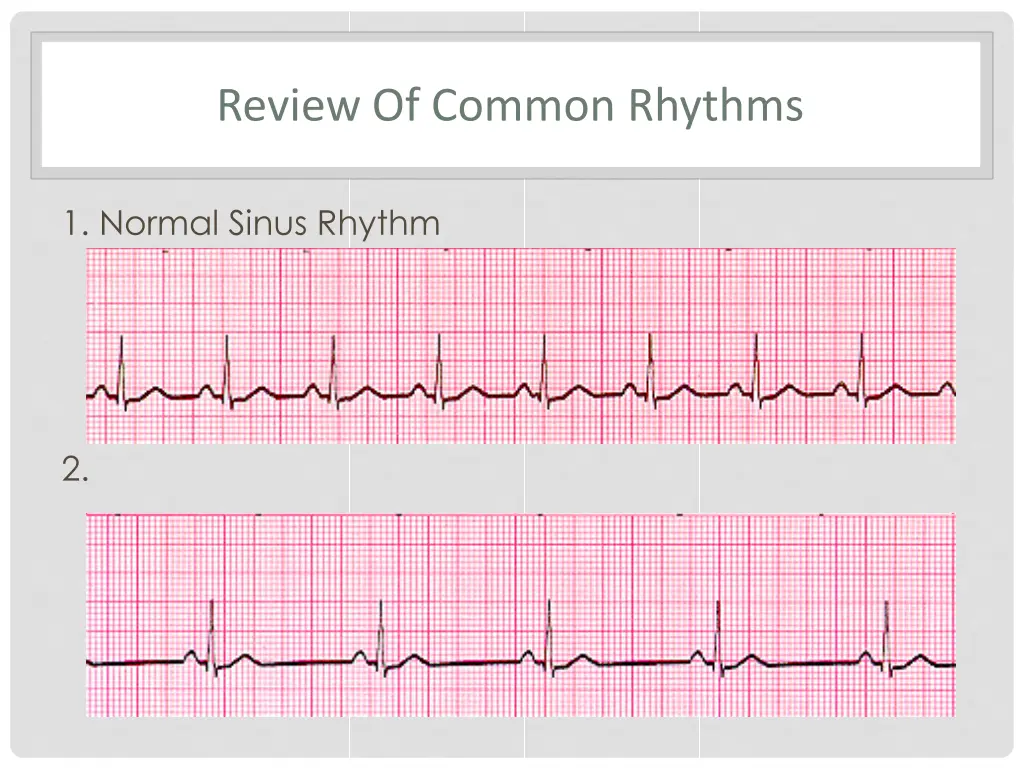 review of common rhythms