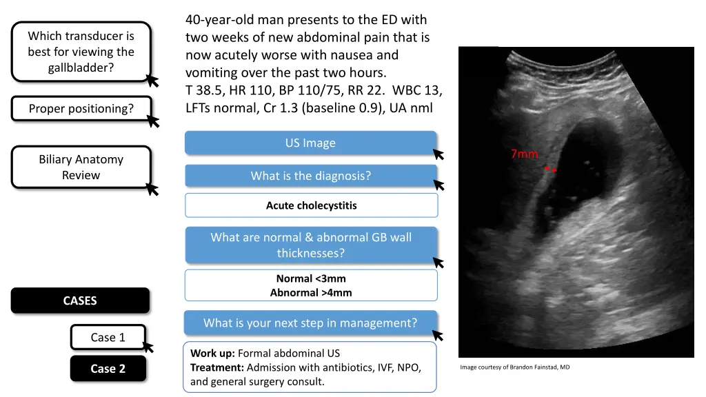 40 year old man presents to the ed with two weeks