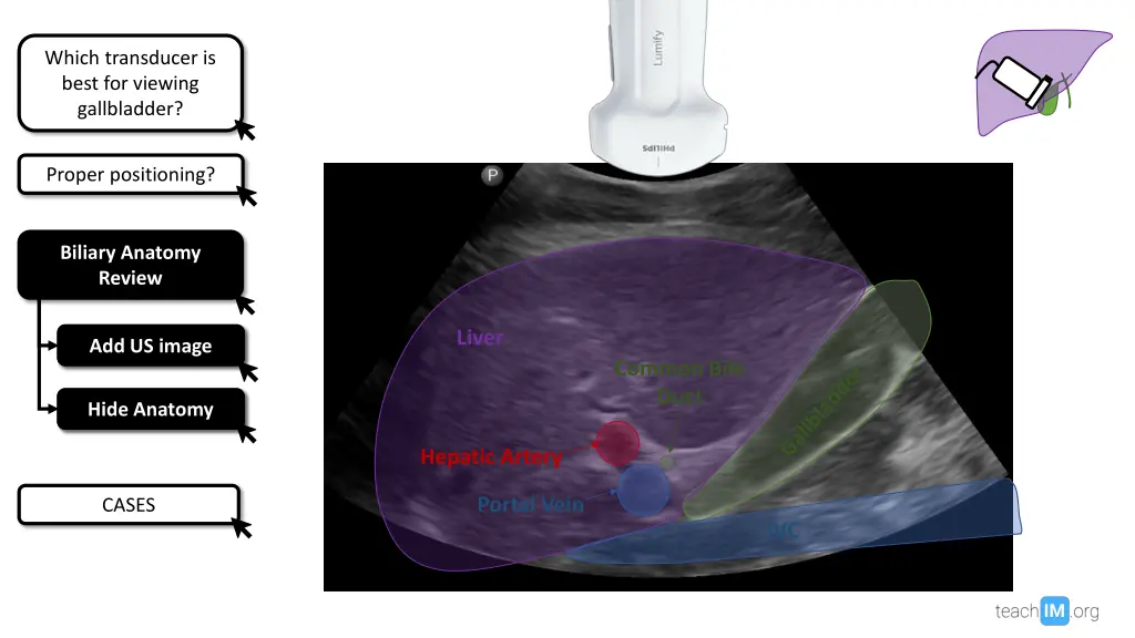 which transducer is best for viewing gallbladder