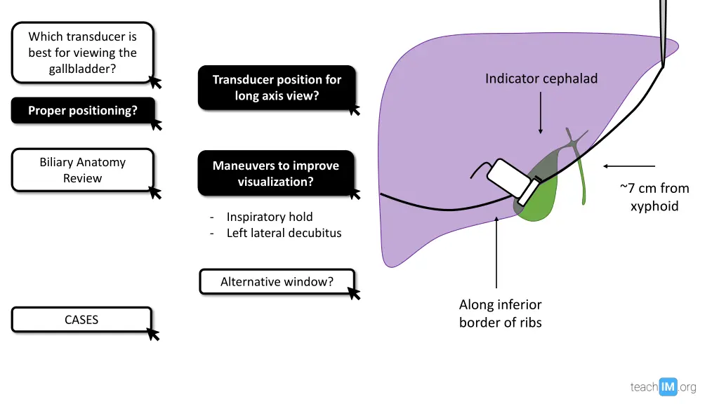 which transducer is best for viewing