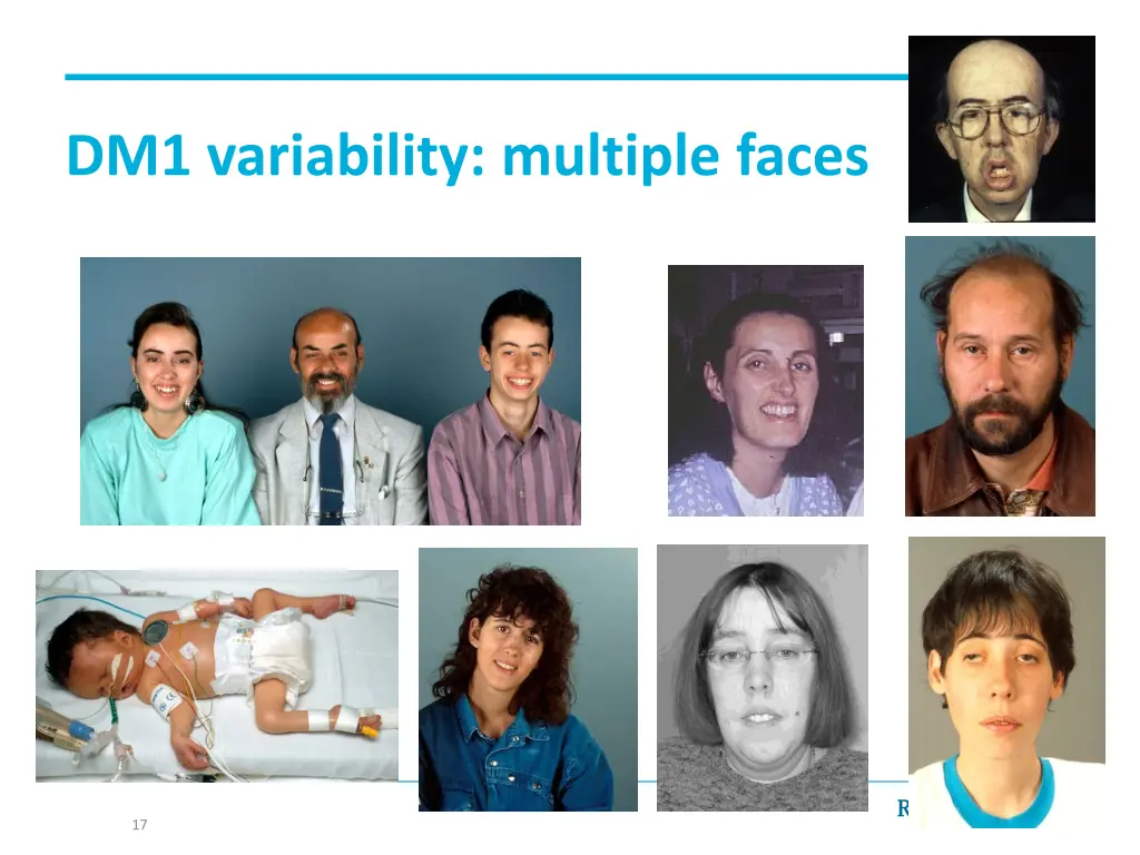 dm1 variability multiple faces