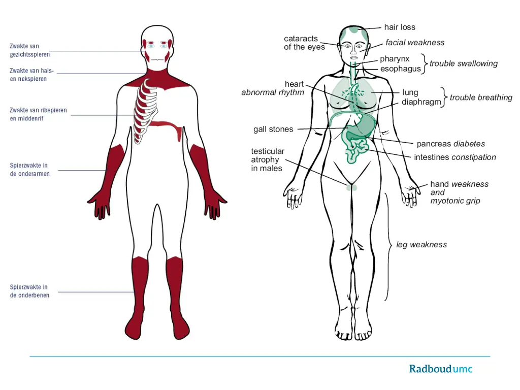 multisysteem