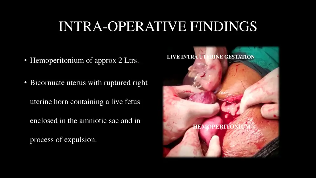 intra operative findings