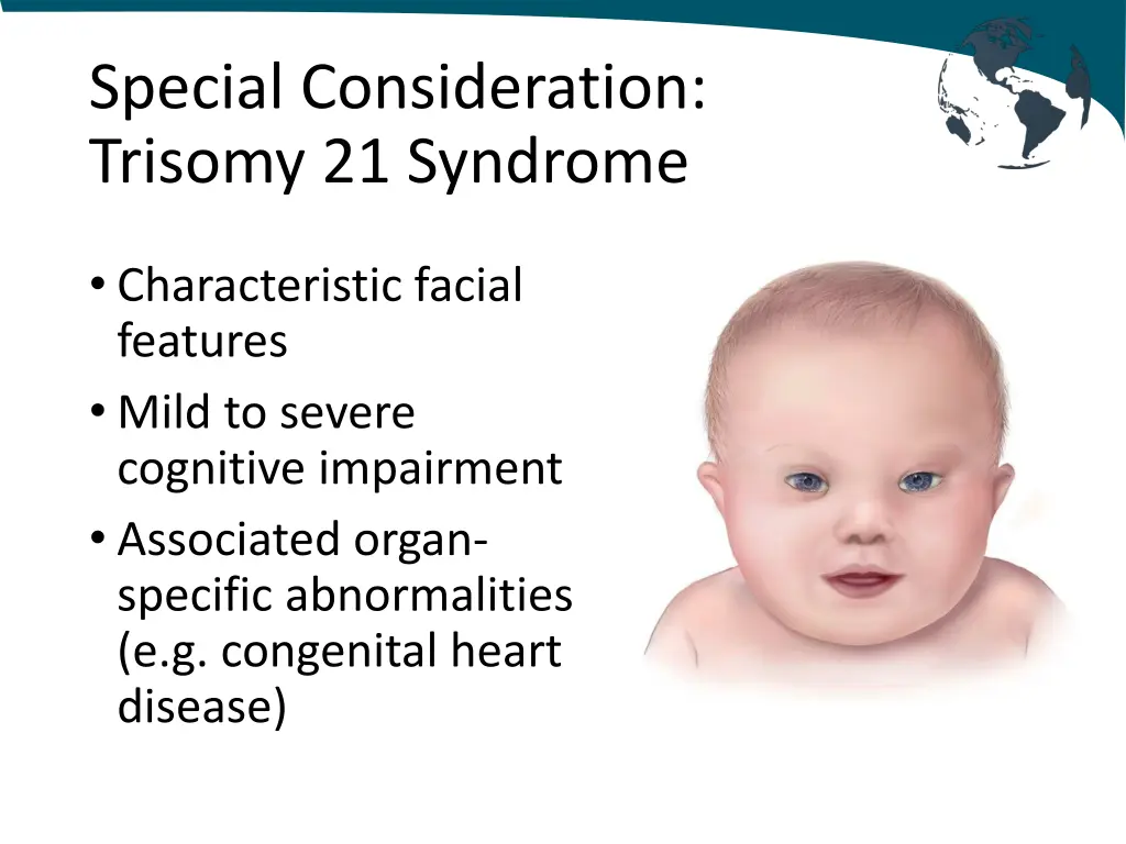 special consideration trisomy 21 syndrome