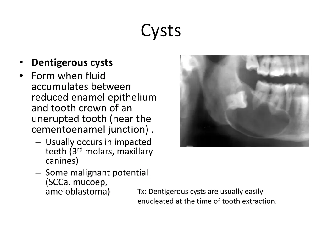 cysts 1