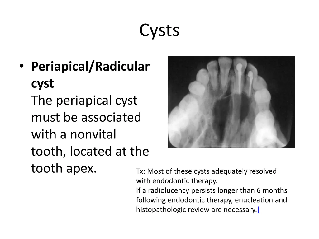 cysts