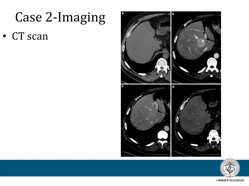 case 2 imaging ct scan