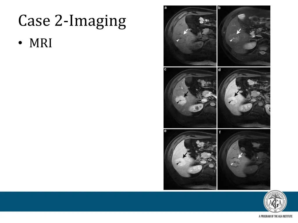 case 2 imaging mri