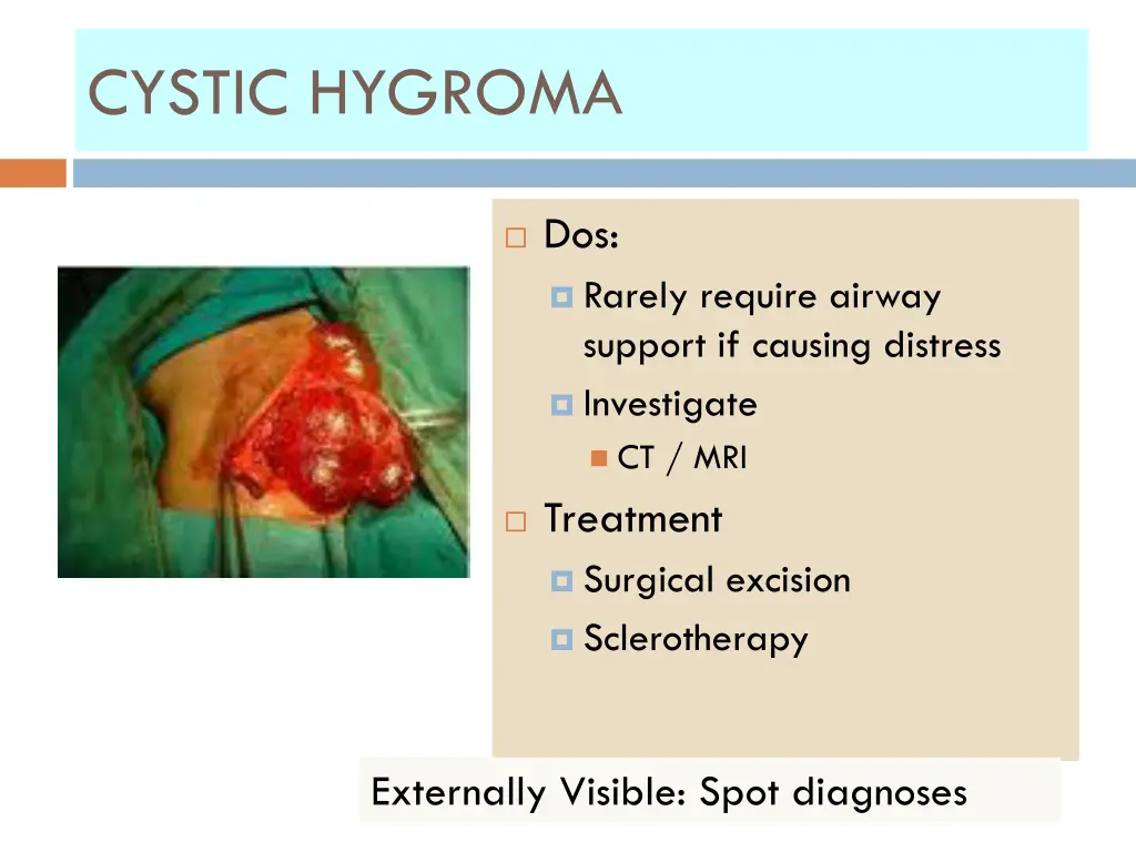 cystic hygroma 1