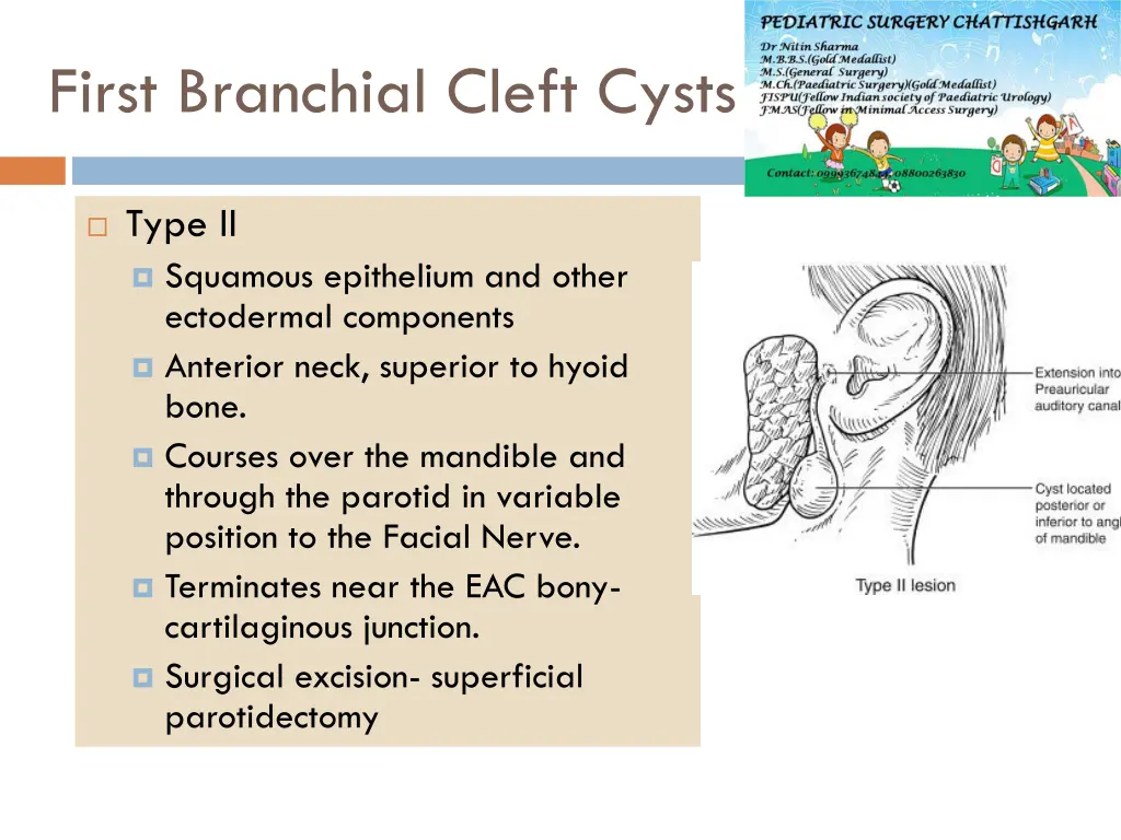 first branchial cleft cysts 1