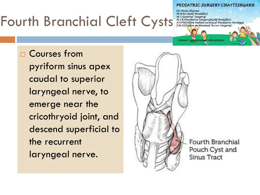 fourth branchial cleft cysts