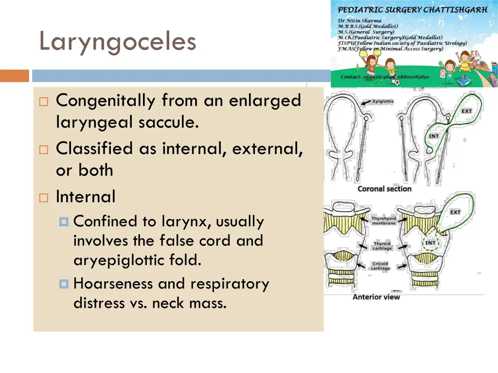 laryngoceles