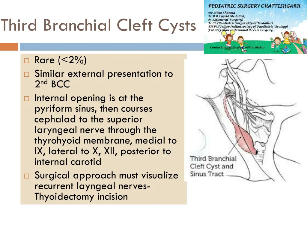 third branchial cleft cysts