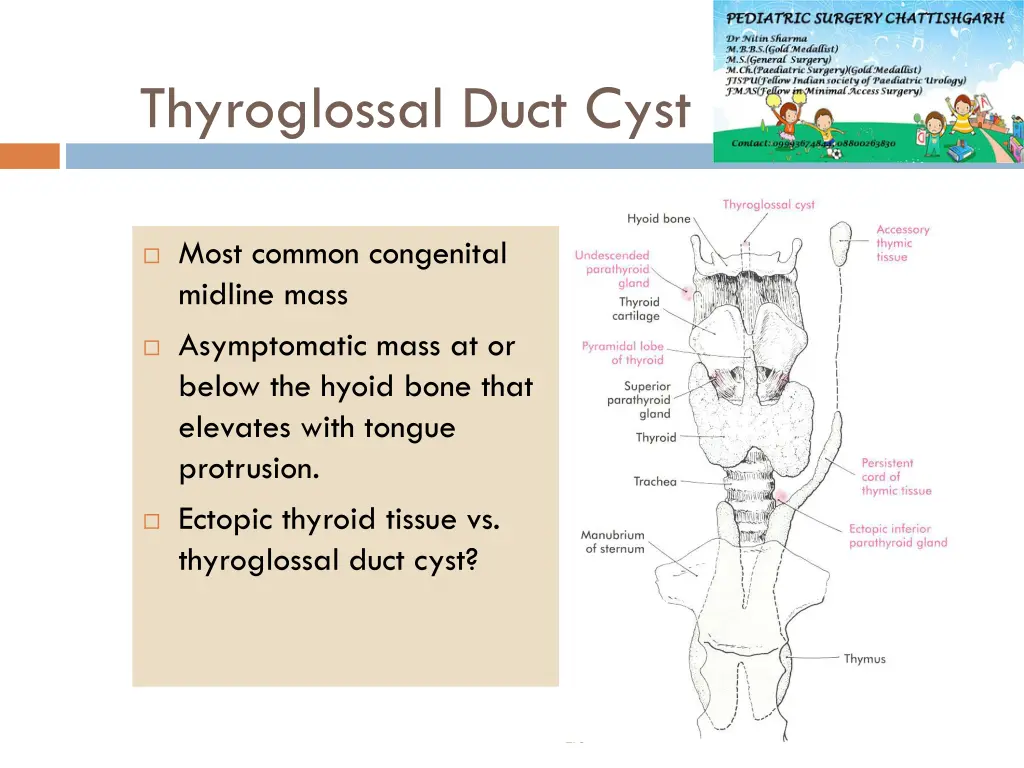 thyroglossal duct cyst