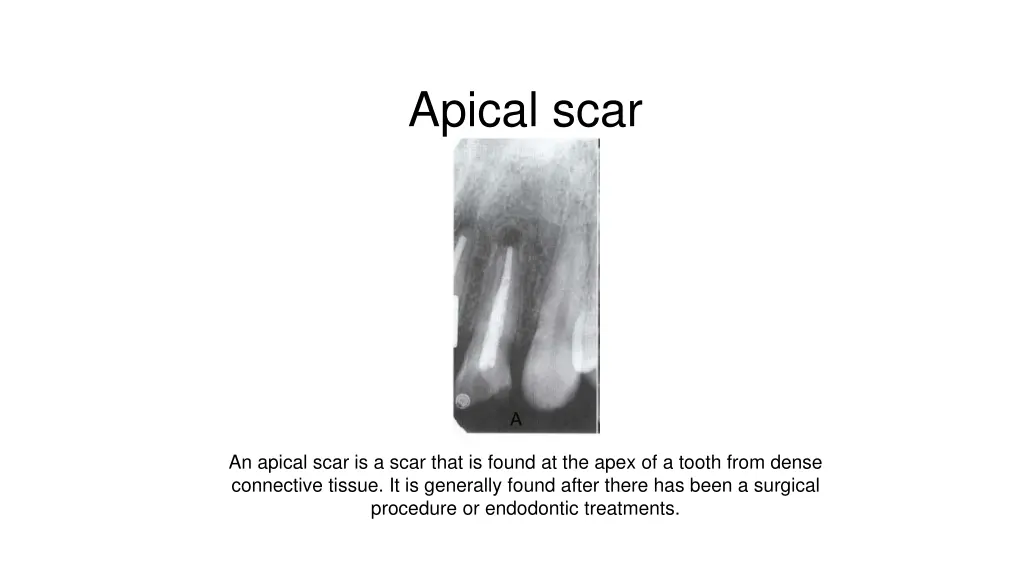 apical scar