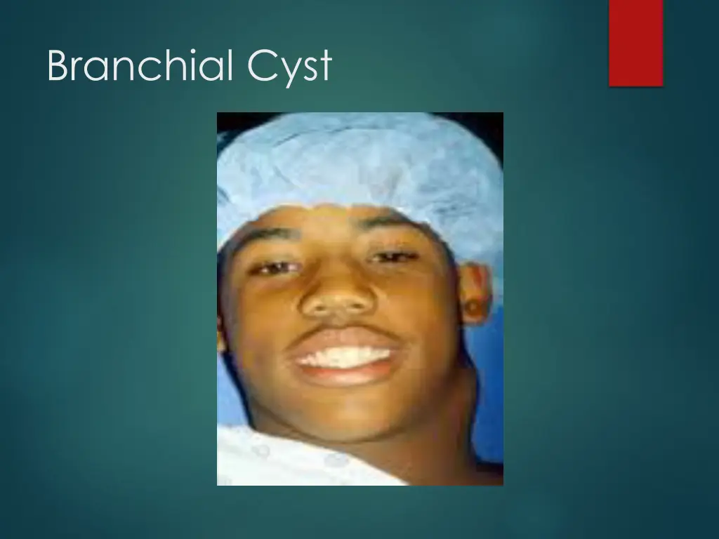 branchial cyst