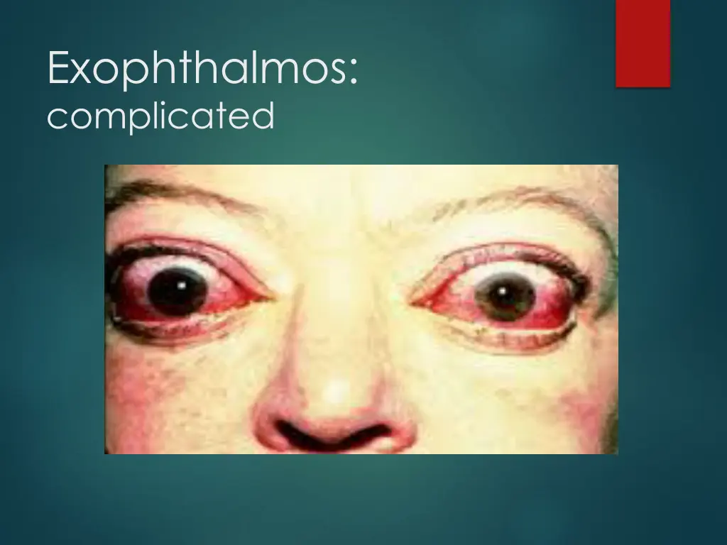 exophthalmos complicated