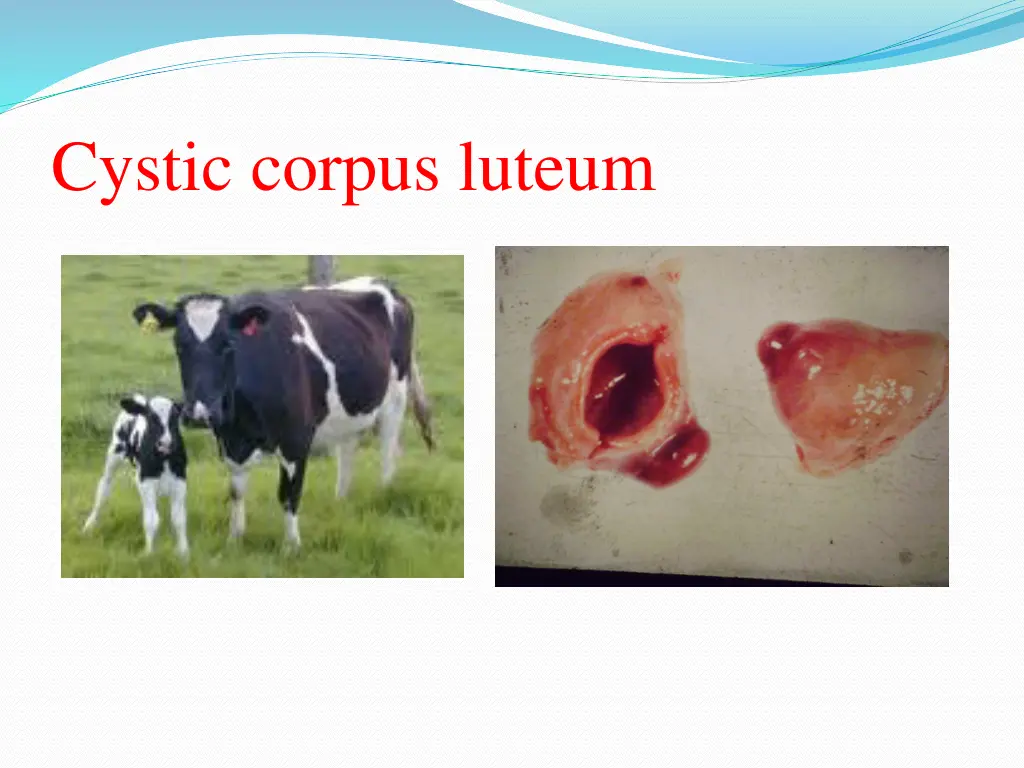 cystic corpus luteum