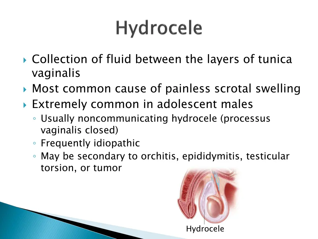 collection of fluid between the layers of tunica