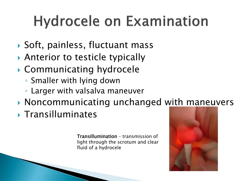 soft painless fluctuant mass anterior to testicle