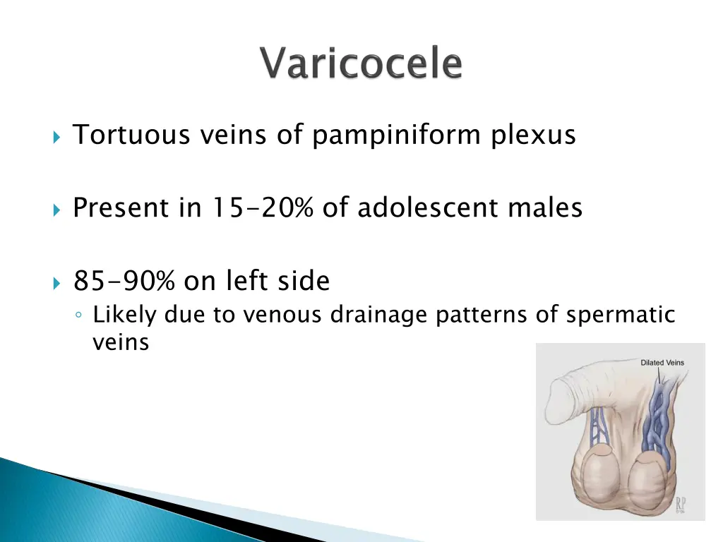 tortuous veins of pampiniform plexus