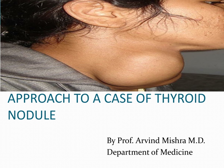 approach to a case of thyroid nodule