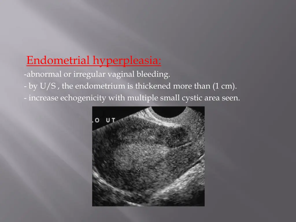 endometrial hyperpleasia abnormal or irregular