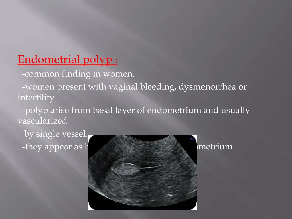 endometrial polyp common finding in women women