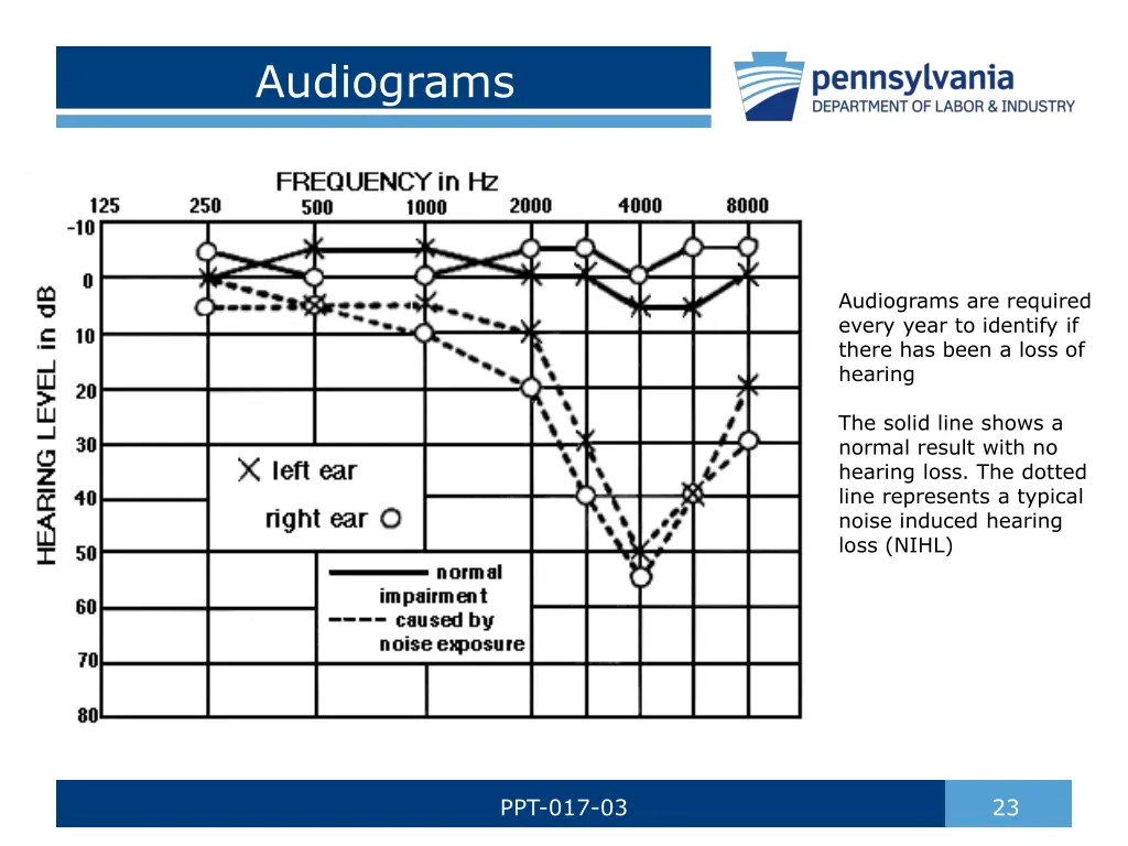 audiograms