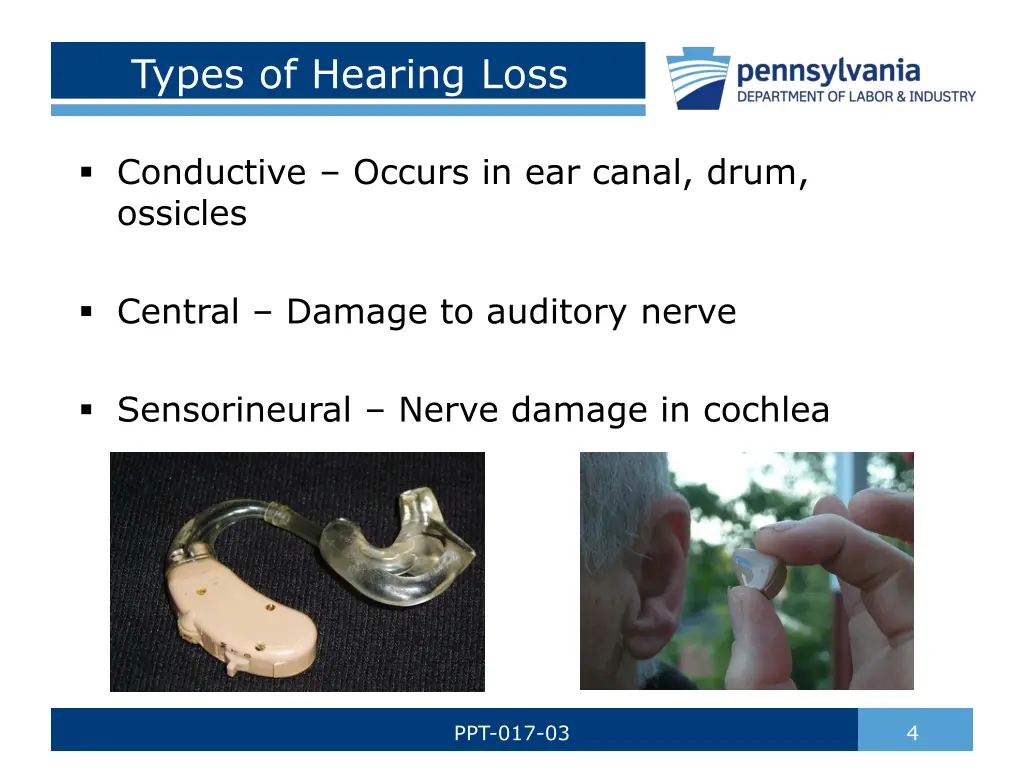 types of hearing loss