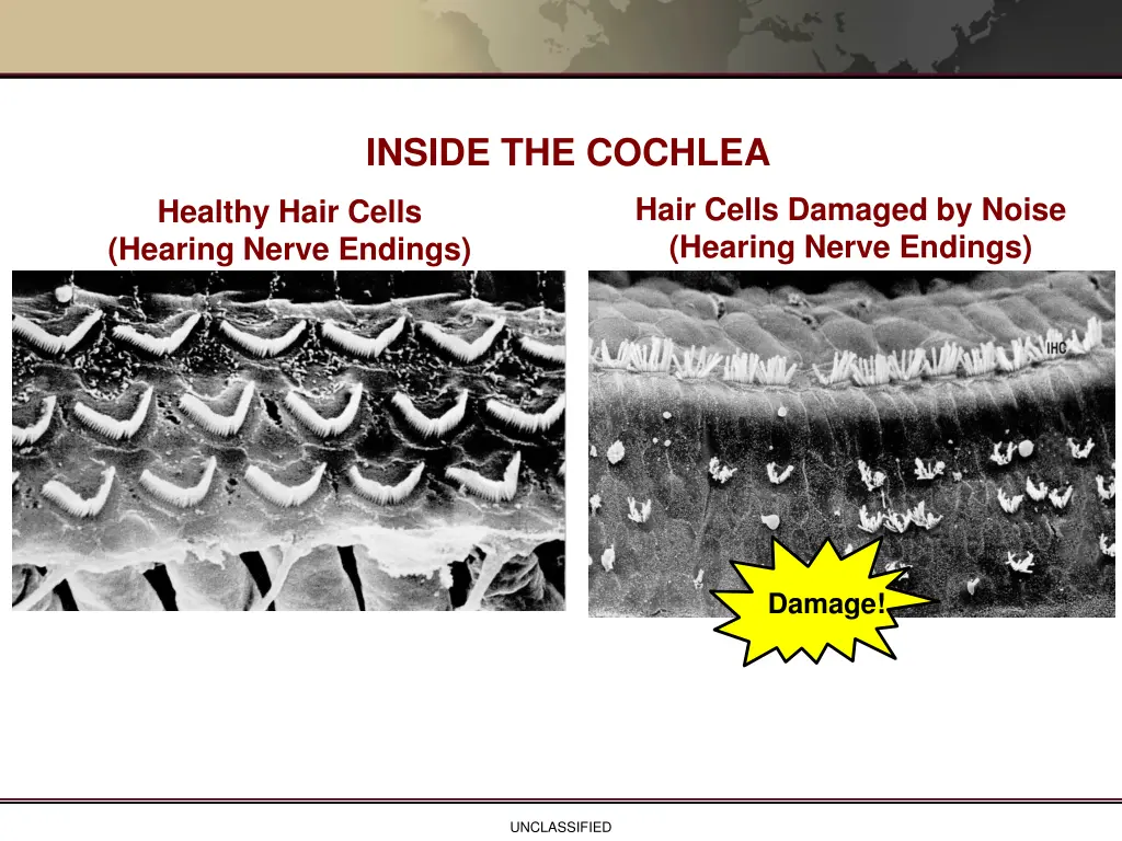 inside the cochlea