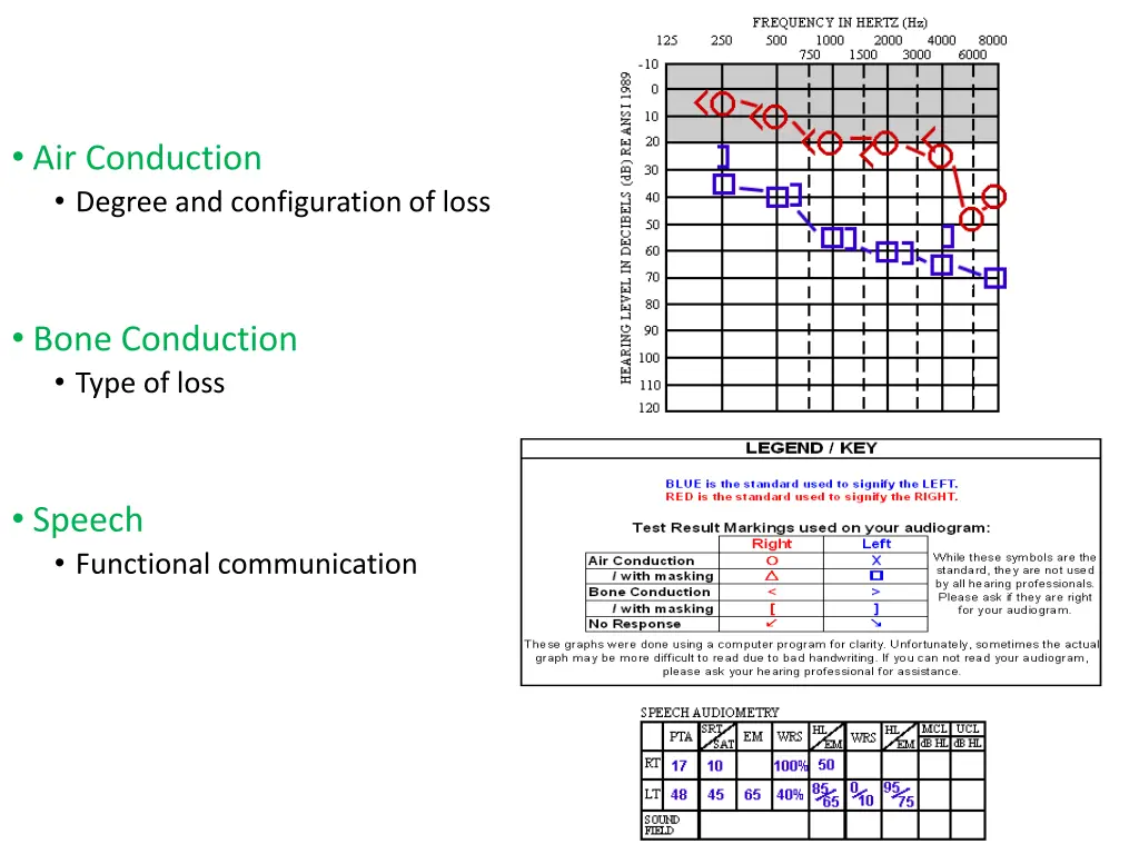 air conduction degree and configuration of loss