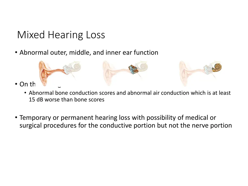 mixed hearing loss