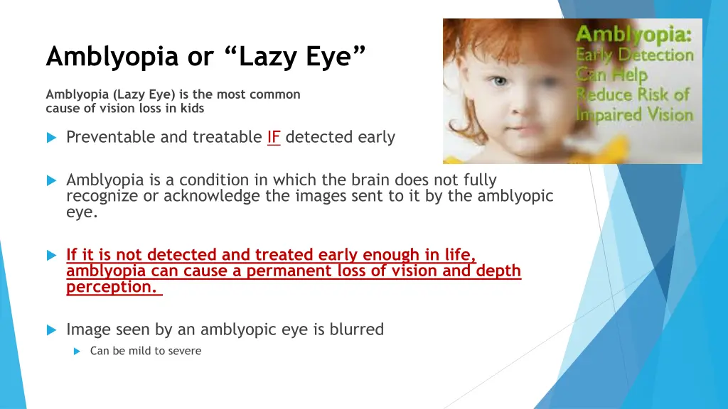 amblyopia or lazy eye