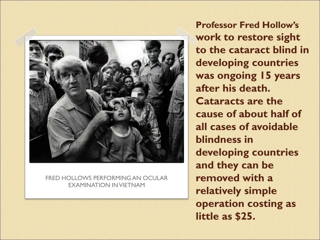 professor fred hollow s work to restore sight