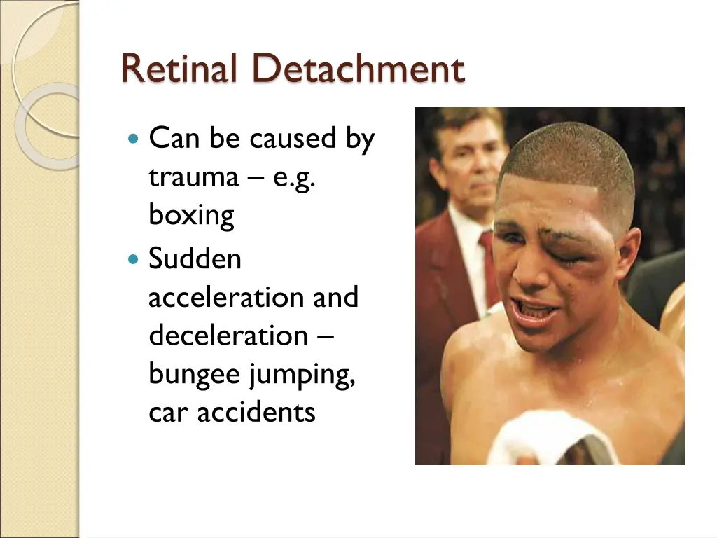 retinal detachment