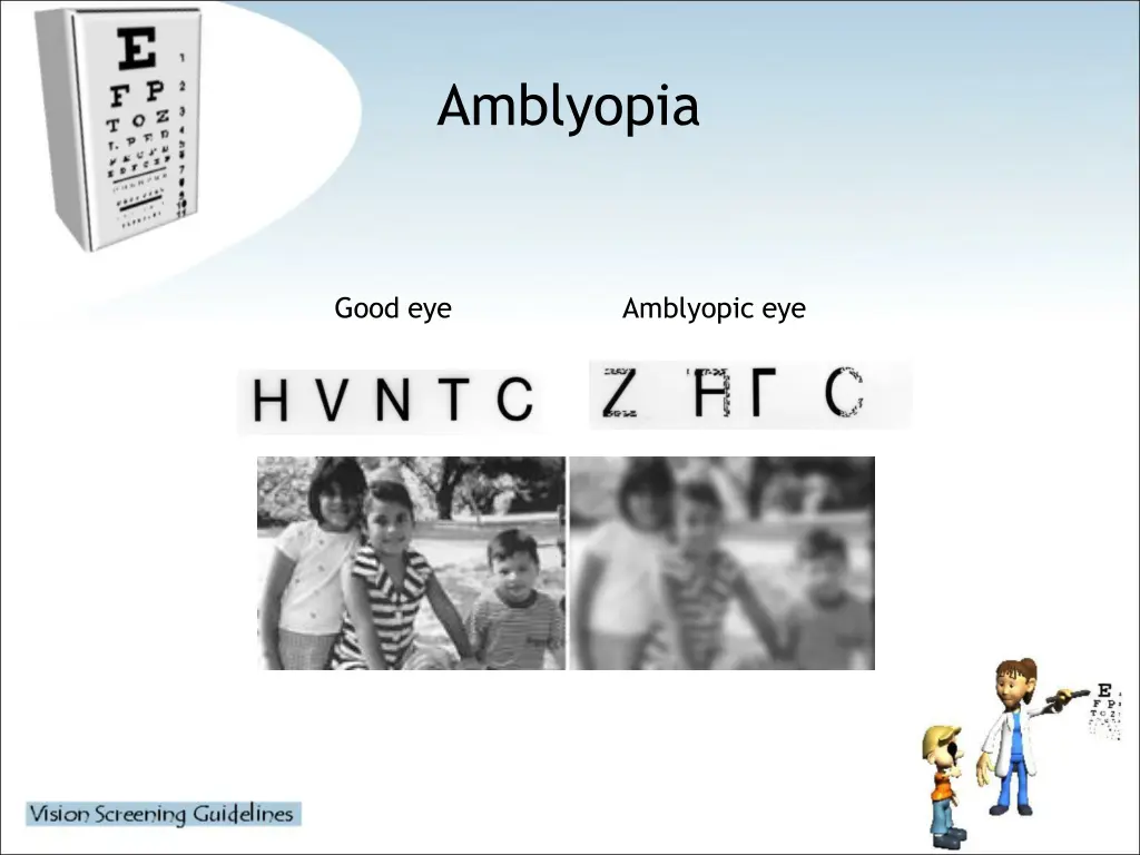 amblyopia 1