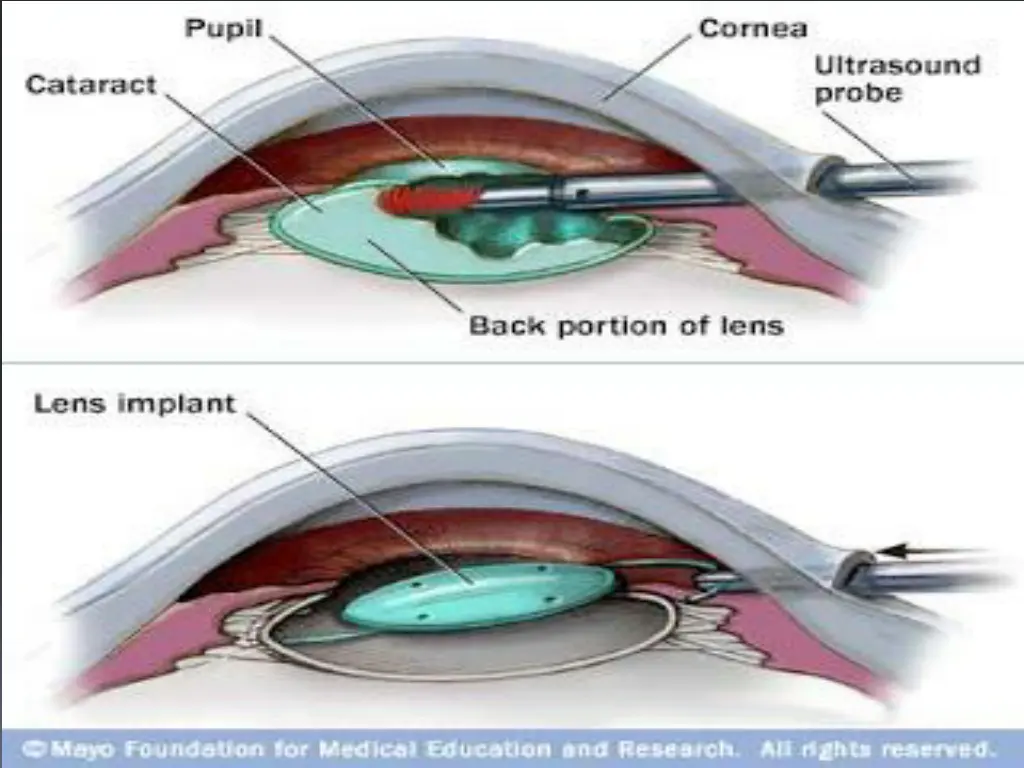 slide21