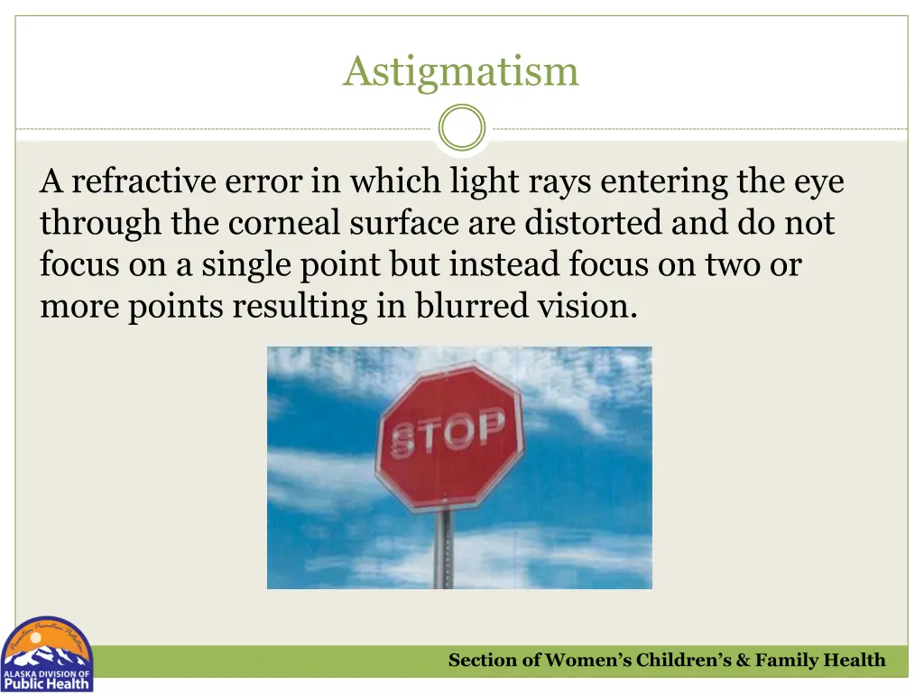 astigmatism