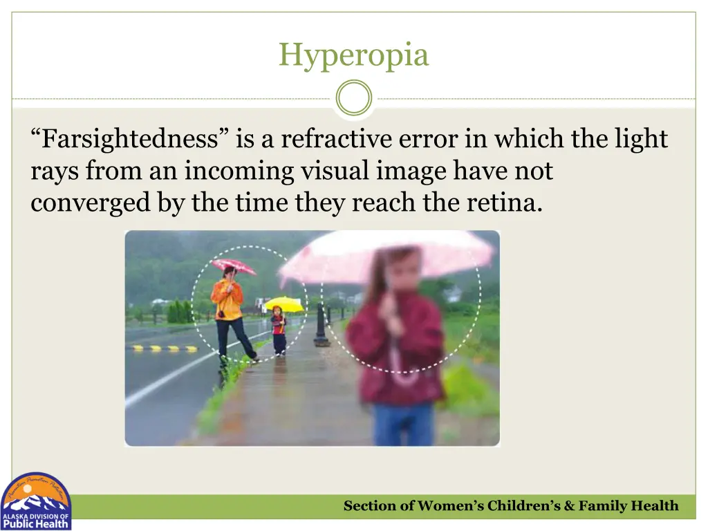 hyperopia