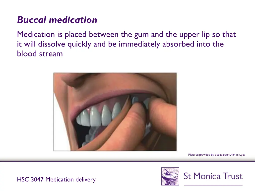 buccal medication medication is placed between